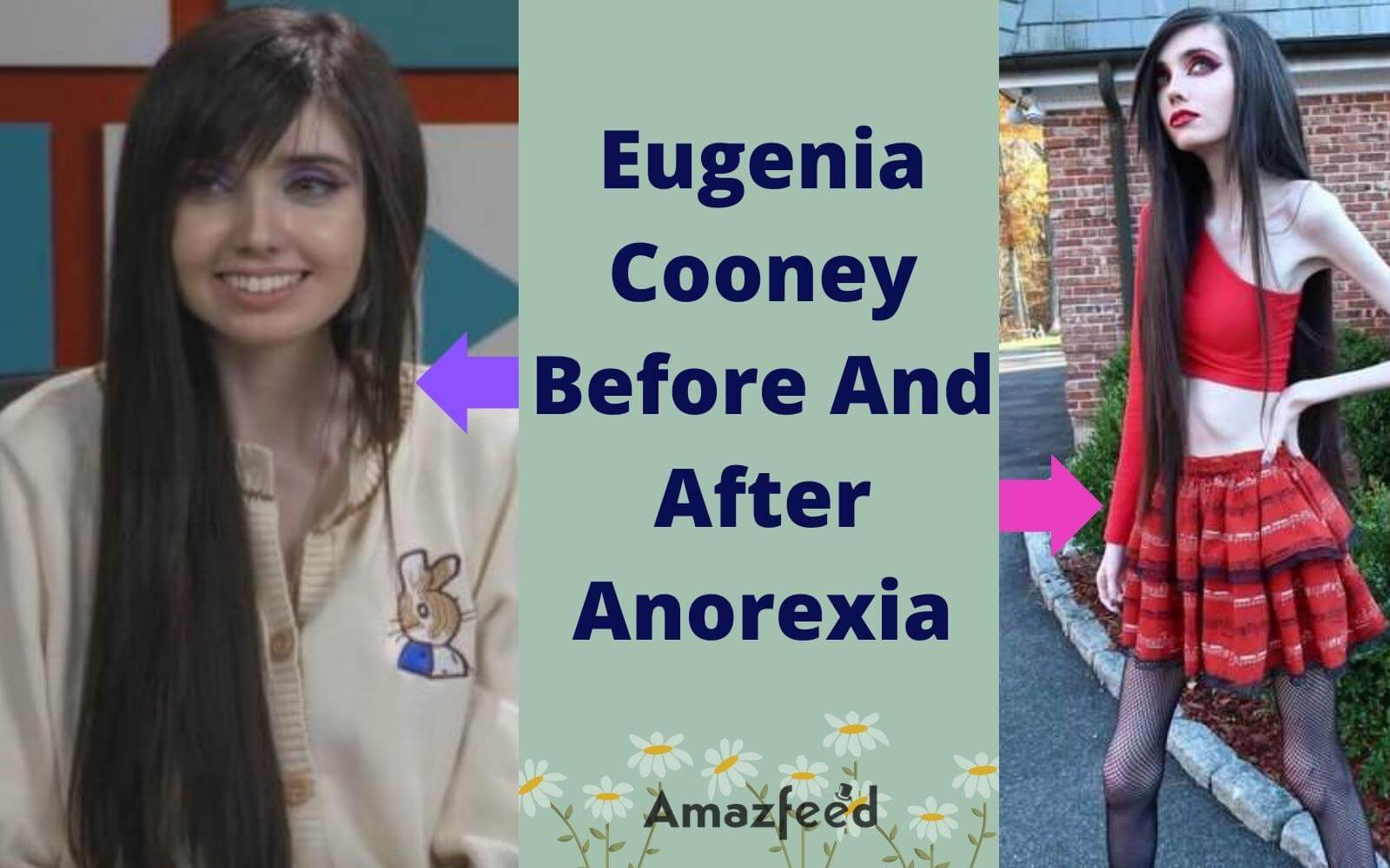 Eugenia Cooney Before And After Anorexia