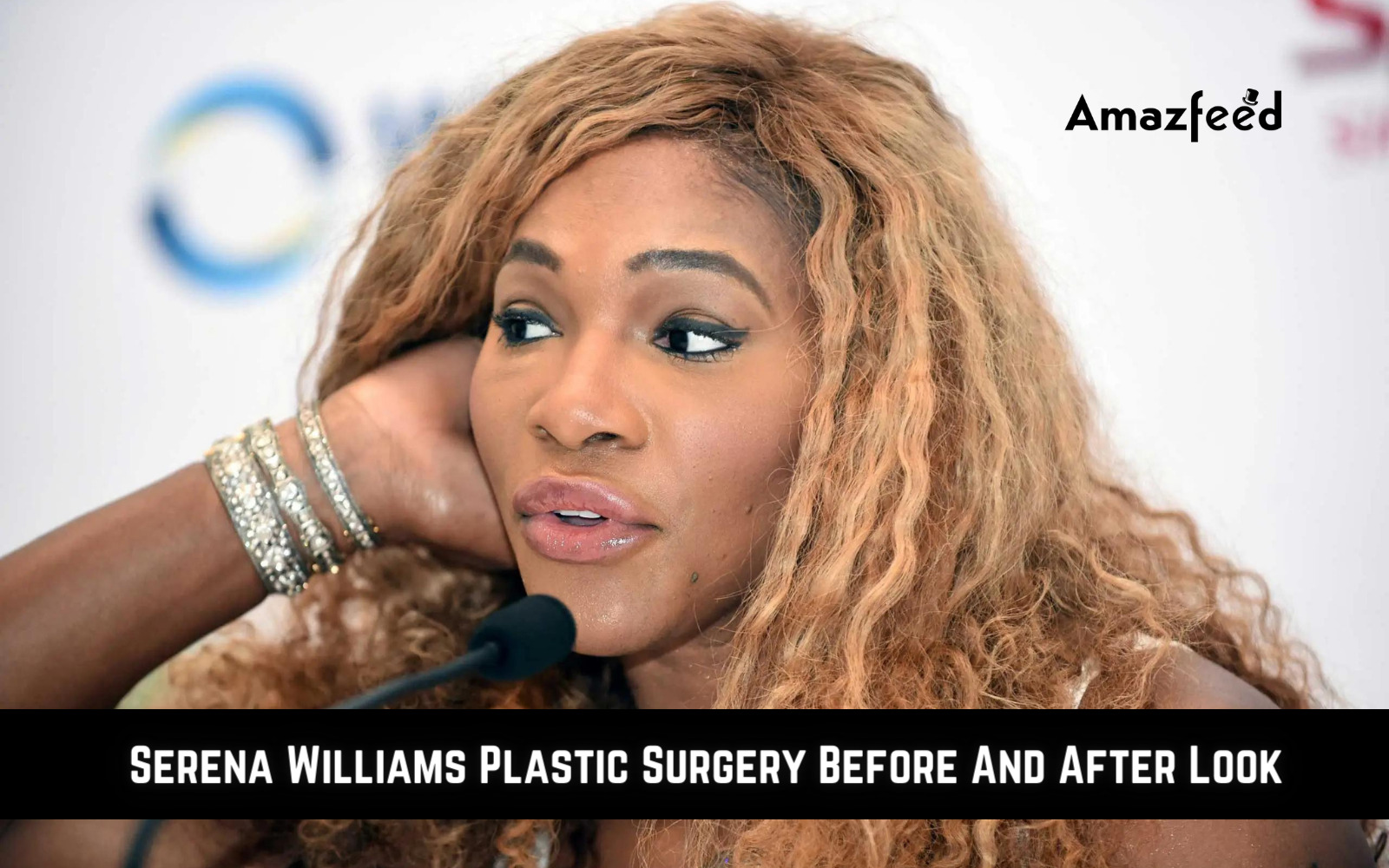 Serena Williams Plastic Surgery Before And After Look
